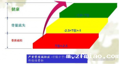 超声骨密度仪可以轻松的告诉你骨密度正常值是多少从而判断骨质量的一个重要