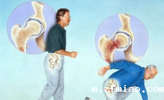 超声骨密度检测仪的应用范围