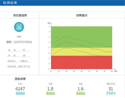 骨密度分析仪厂家简述定期检查骨密度值有什么好处 骨密度分析仪厂家简述定期检查骨密度值有什么好处(图1)
