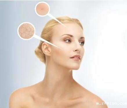 超声骨密度仪生产厂家提示皮肤干燥的女性更容易骨折 超声骨密度仪生产厂家提示皮肤干燥的女性更容易骨折