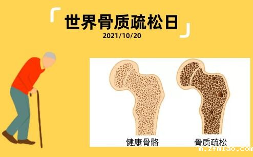 儿童骨密度仪提示【全球骨质疏松症日】年高不移松柏志日常养生骨弥坚 儿童骨密度仪提示【全球骨质疏松症日】年高不移松柏志日常养生骨弥坚
