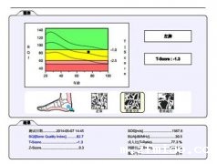 国产骨密度检测仪厂家价格是怎么定位的?国康小编知晓一二!
