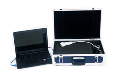 超声骨密度检测仪