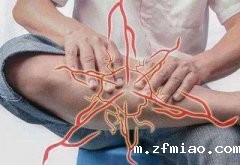 便携式骨密度检测仪厂家分析腿抽筋与骨密度关系
