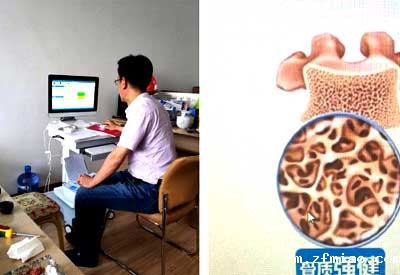 我们医院近期要采购一台超声骨密度检测仪但是选择出现分歧