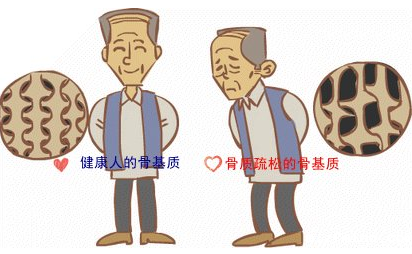 MQD-7000【骨密度仪】品牌新利18体育娱乐app菲律宾提出，预防和筛查骨质疏松症是当务之急