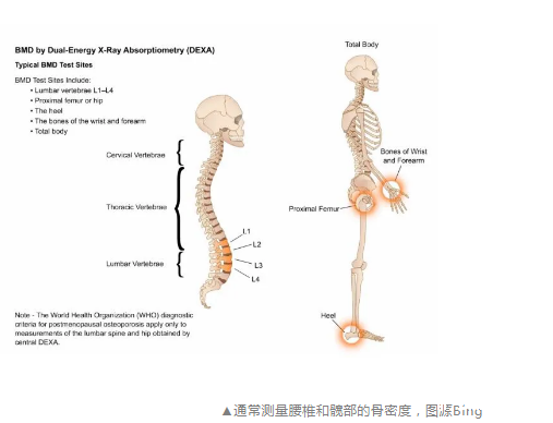 超声波【骨密度检测仪​】品牌国康介绍测骨密度的部位是哪哦？咱们来看一哈~