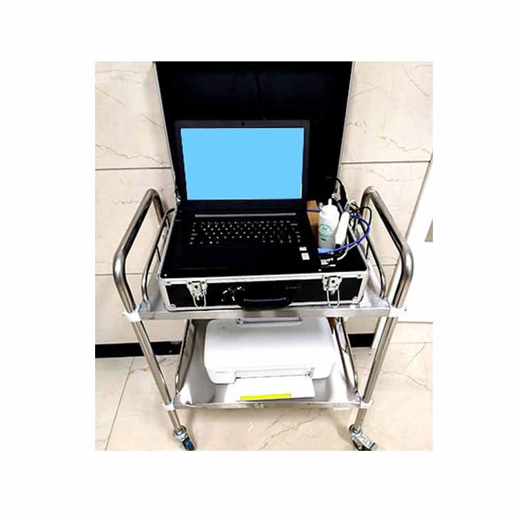 便携式骨密度检测仪 便携式骨密度检测仪