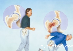 价位合理检测量高的超声骨密度测试仪厂家去哪里购买?