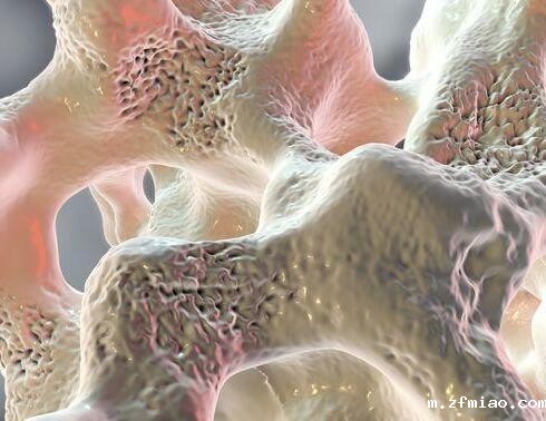 5月关注超声骨密度仪品牌国康提示骨骼不健康对人体的影响
