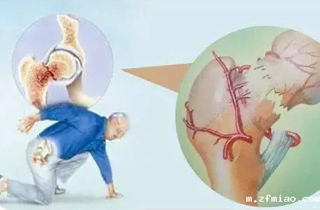 MQD-7000类型国产超声骨密度仪生产厂家提议骨质疏松应该增加骨密度吗？