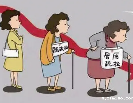 【骨密度检测仪】品牌国康提醒：女人别等到50岁才防骨质疏松！