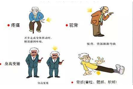 【骨密度仪】生产厂家新利18体育娱乐app菲律宾谈骨质疏松患者，疏忽 2 点，补再多钙也没用！