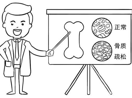 超声骨密度分析仪品牌国康建议除了骨密度外，这是骨质疏松症治疗最重要的监测指标!