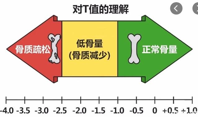 新利18体育娱乐app菲律宾骨密度仪厂家研发的骨密度的测量方式